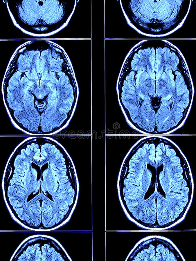 Modality CT scan 